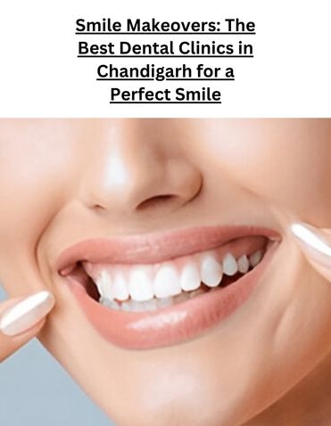 Smile Makeovers: The Best Dental Clinics in Chandigarh for a Perfect Smile