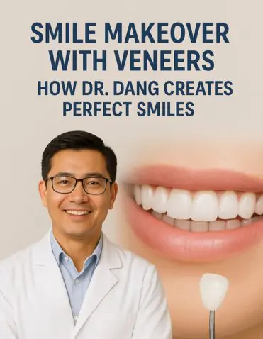 SMILE MAKEOVER WITH VENEERS: HOW DR. DANG CREATES PERFECT SMILES