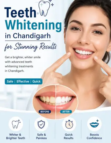 Teeth Whitening in Chandigarh for Stunning Results