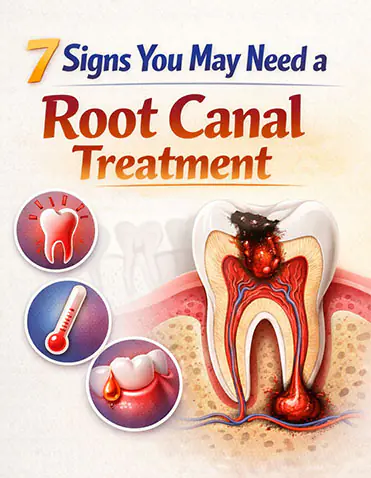7 Signs You May Need a Root Canal Treatment