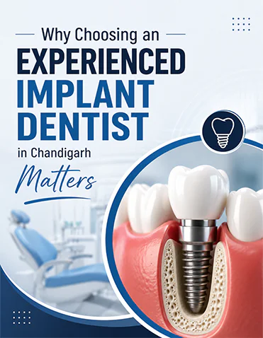 Why Choosing an Experienced Implant Dentist in Chandigarh Matters